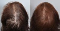 Nina Ross Hair & Skin Therapy Atlanta image 4